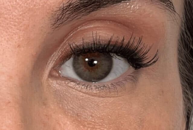 Eye rejuvenation after treatment