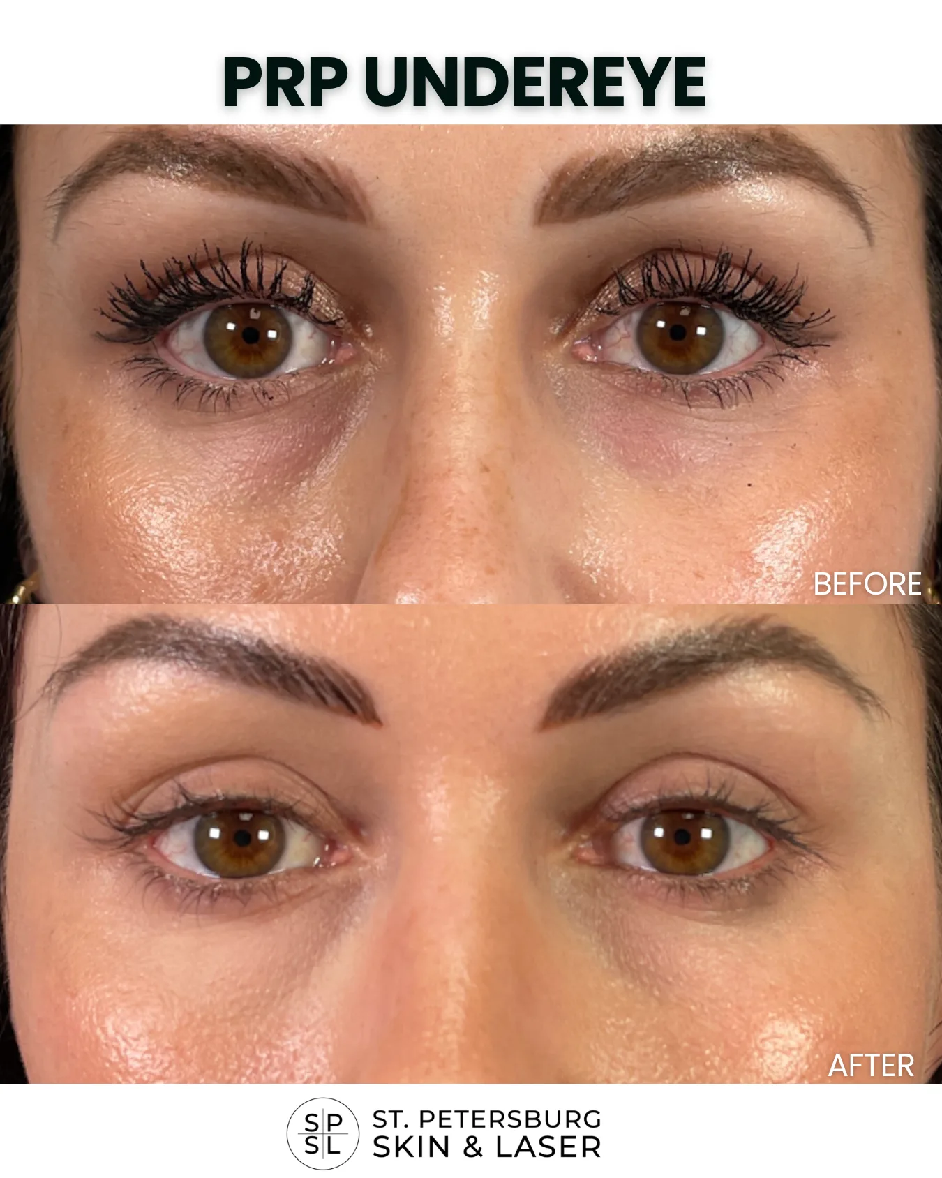 Other Procedures before and after results