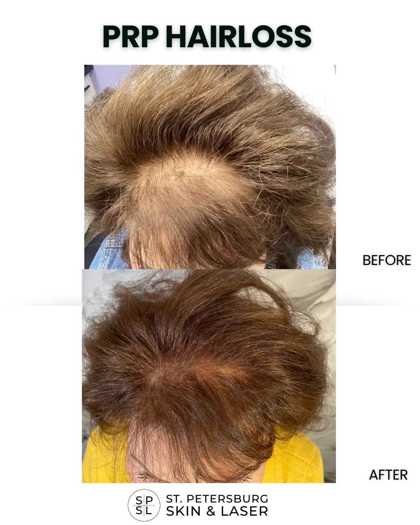 Other Procedures before and after results