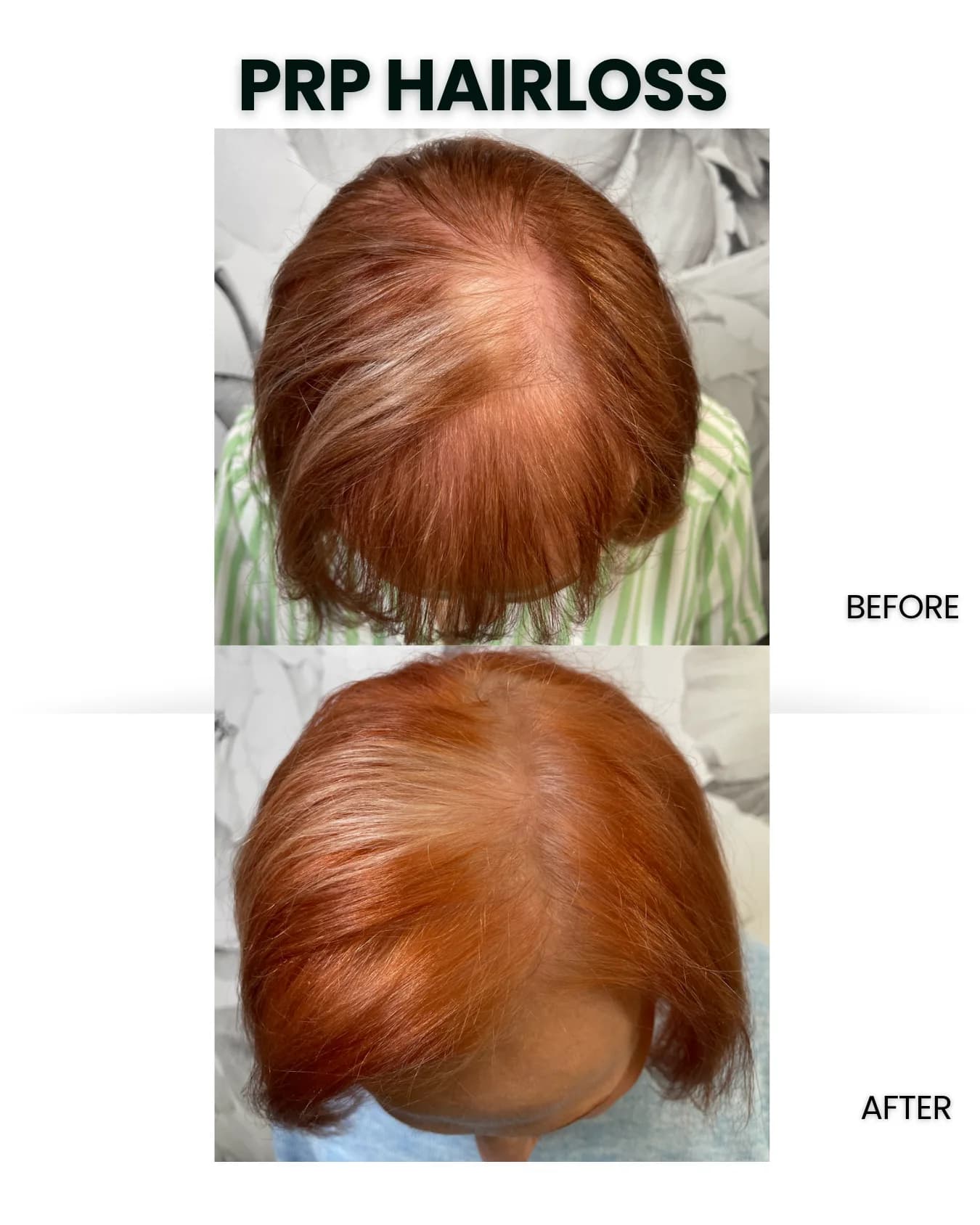 Other Procedures before and after results
