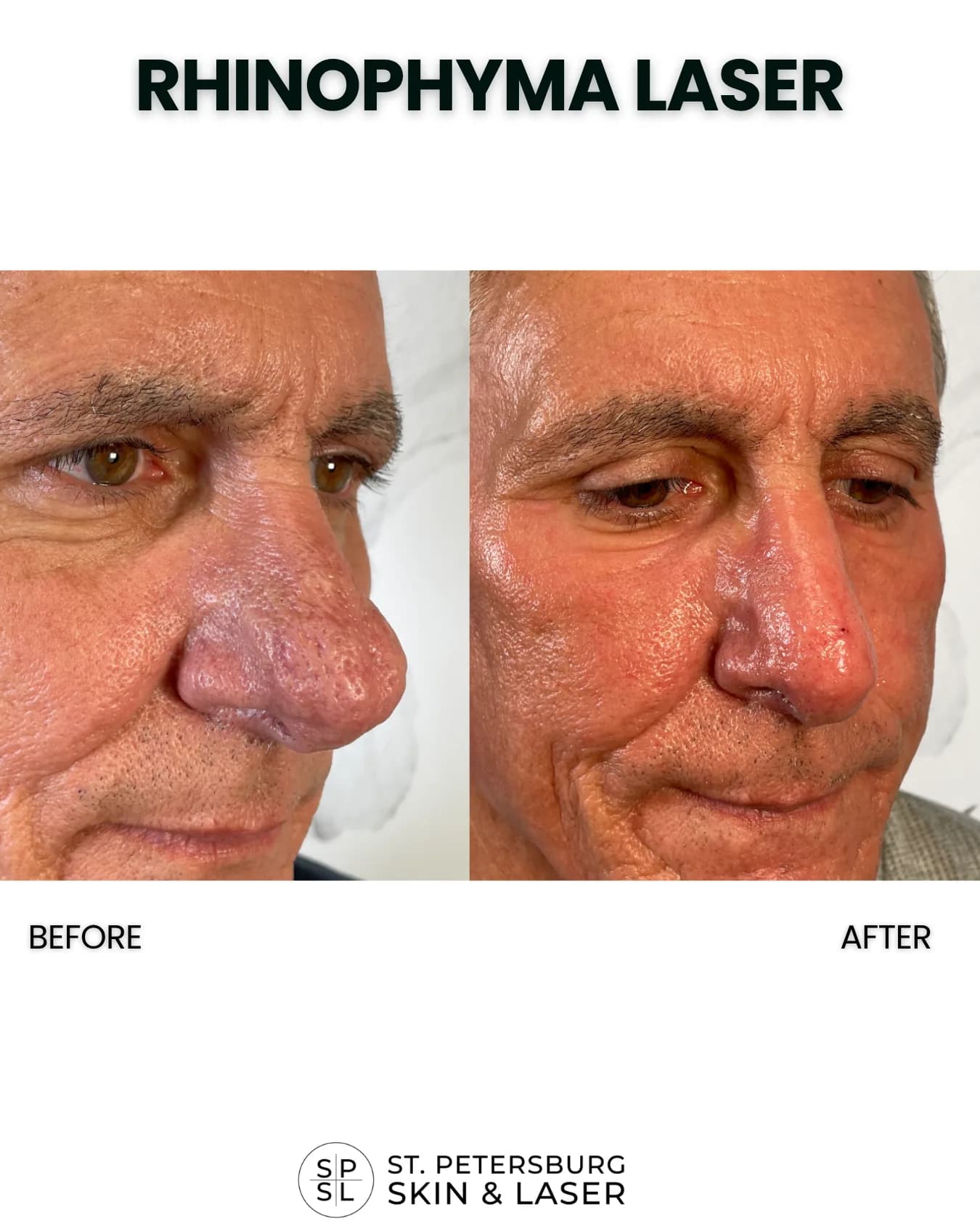 Other Procedures before and after results