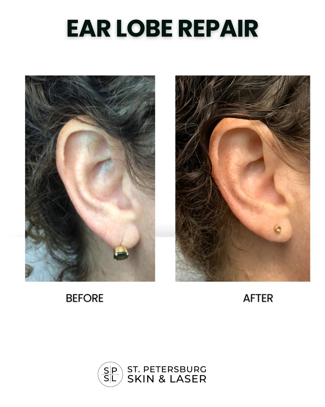 Other Procedures before and after results