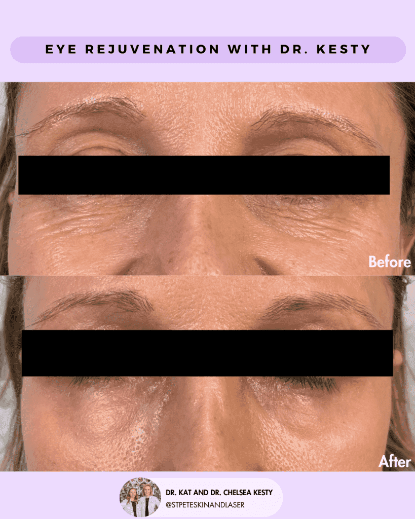 Other Cosmetic Procedures before and after results