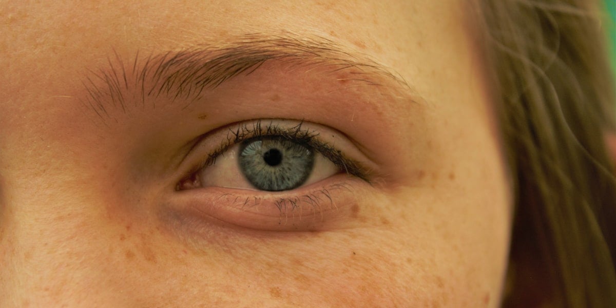 Professional portrait of woman showcasing natural beauty and clear skin for eye rejuvenation treatments